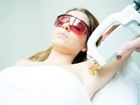 Who Is the Ideal Candidate for Magic Laser Hair Removal?